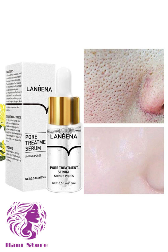 سرم بستن منافذ باز